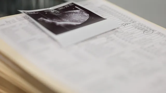 Pregnant woman in brain death in the US kept alive due to abortion ban