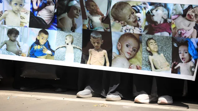 Children in Gaza are so hungry that they no longer have the strength to cry
